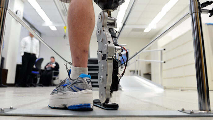 A patient tests out an experimental prosthetic leg at the Rehabilitation Institute of Chicago|Dr. Henry Betts.